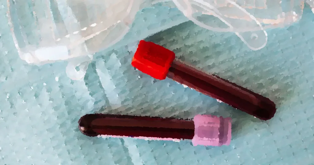 Top view closeup of protective plastic eyeglasses and full of blood vials placed on medical diaper